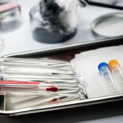 Columna Cromatográfica para Análisis Forense